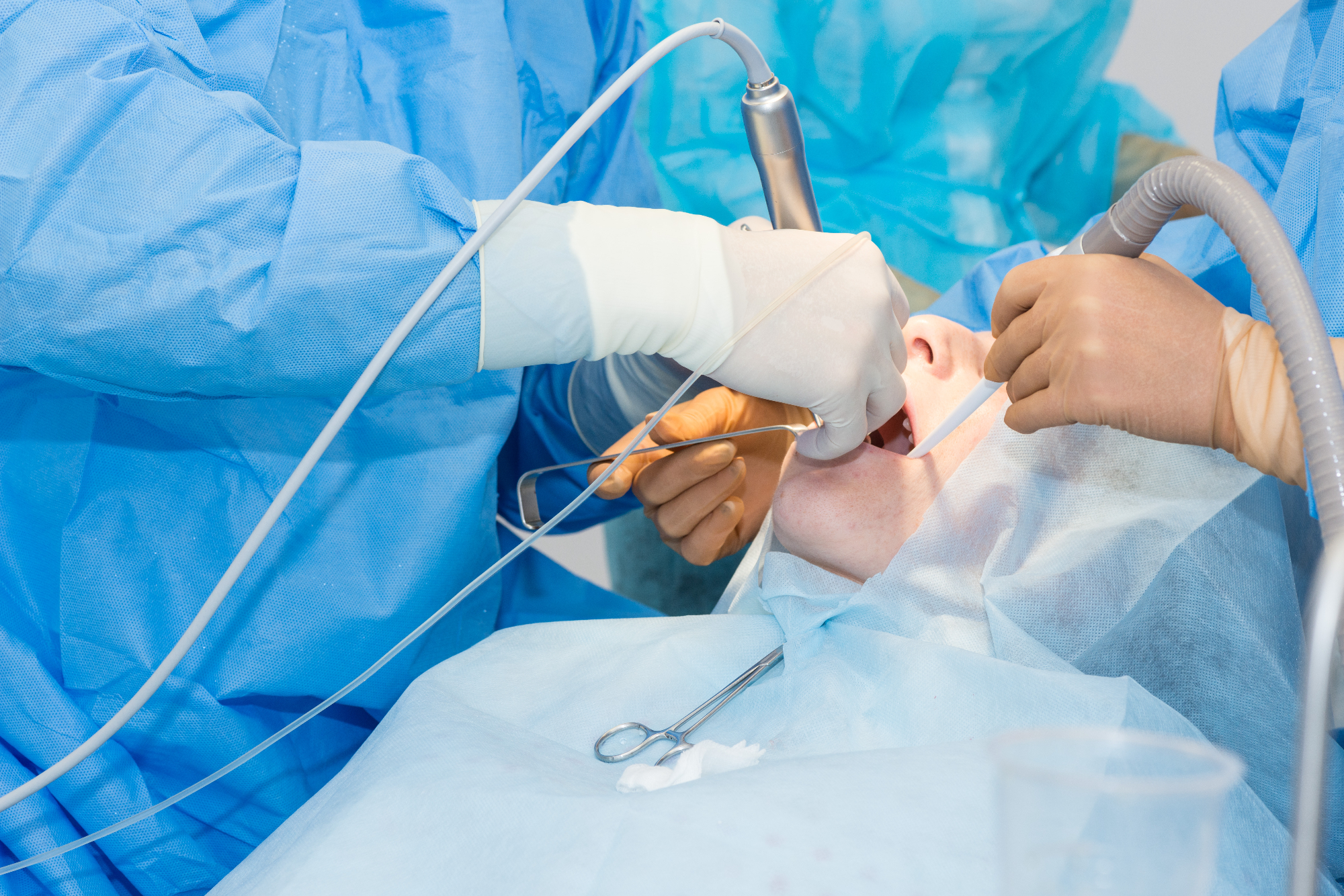 Mojemu znancu je pomagal zobni kirurg Koper izpuliti modrostni zob